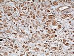 SEC5/EXOC2 Antibody in Immunohistochemistry (Paraffin) (IHC (P))