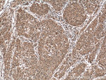 SEC5/EXOC2 Antibody in Immunohistochemistry (Paraffin) (IHC (P))