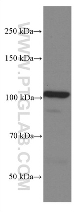 SEC5/EXOC2 Antibody in Western Blot (WB)