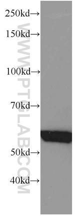 GEFT Antibody in Western Blot (WB)