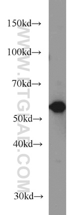 GEFT Antibody in Western Blot (WB)