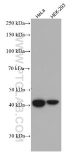 HLA class I ABC Antibody in Western Blot (WB)