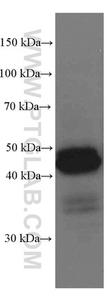 HLA class I ABC Antibody in Western Blot (WB)