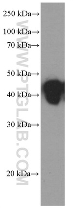 HLA class I ABC Antibody in Western Blot (WB)