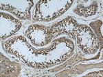 MAD2L1 Antibody in Immunohistochemistry (Paraffin) (IHC (P))