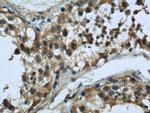 MAD2L1 Antibody in Immunohistochemistry (Paraffin) (IHC (P))