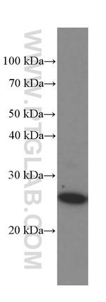 MAD2L1 Antibody in Western Blot (WB)