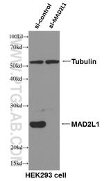 MAD2L1 Antibody in Western Blot (WB)