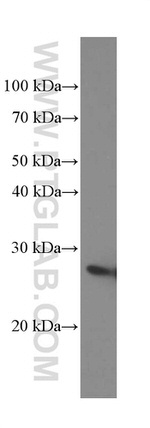 MAD2L1 Antibody in Western Blot (WB)