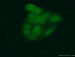 RBBP9 Antibody in Immunocytochemistry (ICC/IF)