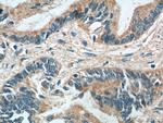 RBBP9 Antibody in Immunohistochemistry (Paraffin) (IHC (P))