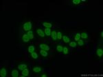 Transketolase Antibody in Immunocytochemistry (ICC/IF)