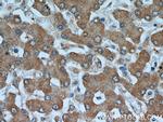 Transketolase Antibody in Immunohistochemistry (Paraffin) (IHC (P))