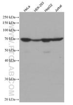 Transketolase Antibody in Western Blot (WB)