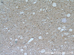 Transketolase Antibody in Immunohistochemistry (Paraffin) (IHC (P))