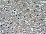 Transketolase Antibody in Immunohistochemistry (Paraffin) (IHC (P))