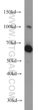 Transketolase Antibody in Western Blot (WB)