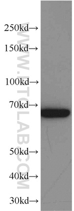 Transketolase Antibody in Western Blot (WB)