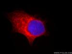 TPPII Antibody in Immunocytochemistry (ICC/IF)