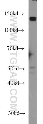 TPPII Antibody in Western Blot (WB)