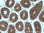 TPPII Antibody in Immunohistochemistry (Paraffin) (IHC (P))