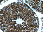 TPPII Antibody in Immunohistochemistry (Paraffin) (IHC (P))