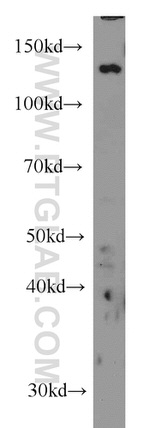 TPPII Antibody in Western Blot (WB)