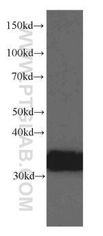 TST Antibody in Western Blot (WB)