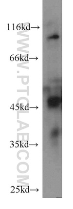 AHCY Antibody in Western Blot (WB)