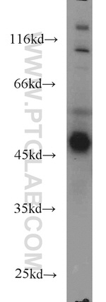 AHCY Antibody in Western Blot (WB)