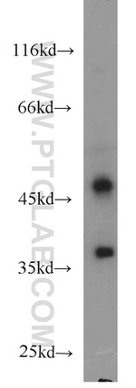 AHCY Antibody in Western Blot (WB)