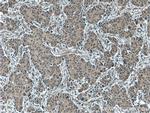 Bcl-XL Antibody in Immunohistochemistry (Paraffin) (IHC (P))