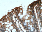 Bcl-XL Antibody in Immunohistochemistry (Paraffin) (IHC (P))