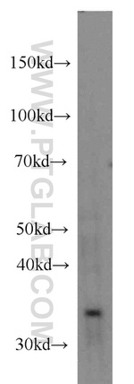 Bcl-XL Antibody in Western Blot (WB)