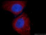 CDC6 Antibody in Immunocytochemistry (ICC/IF)