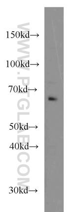 CDC6 Antibody in Western Blot (WB)