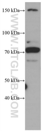 CDC6 Antibody in Western Blot (WB)