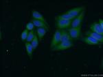 CYB5R3 Antibody in Immunocytochemistry (ICC/IF)