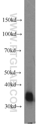 CYB5R3 Antibody in Western Blot (WB)