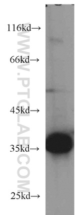 CYB5R3 Antibody in Western Blot (WB)