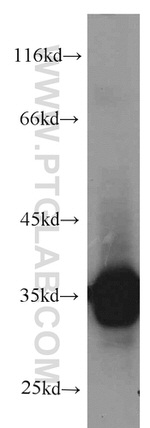 CYB5R3 Antibody in Western Blot (WB)