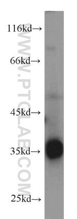 CYB5R3 Antibody in Western Blot (WB)