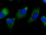 EIF3M Antibody in Immunocytochemistry (ICC/IF)