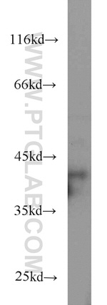 EIF3M Antibody in Western Blot (WB)