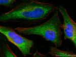 MCL1 Antibody in Immunocytochemistry (ICC/IF)