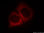 MCL1 Antibody in Immunocytochemistry (ICC/IF)