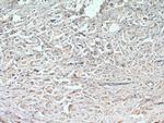 MCL1 Antibody in Immunohistochemistry (Paraffin) (IHC (P))