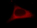 MCL1 Antibody in Immunocytochemistry (ICC/IF)