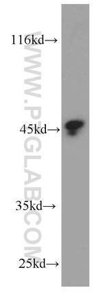 Protein C inhibitor Antibody in Western Blot (WB)