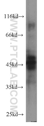 Protein C inhibitor Antibody in Western Blot (WB)